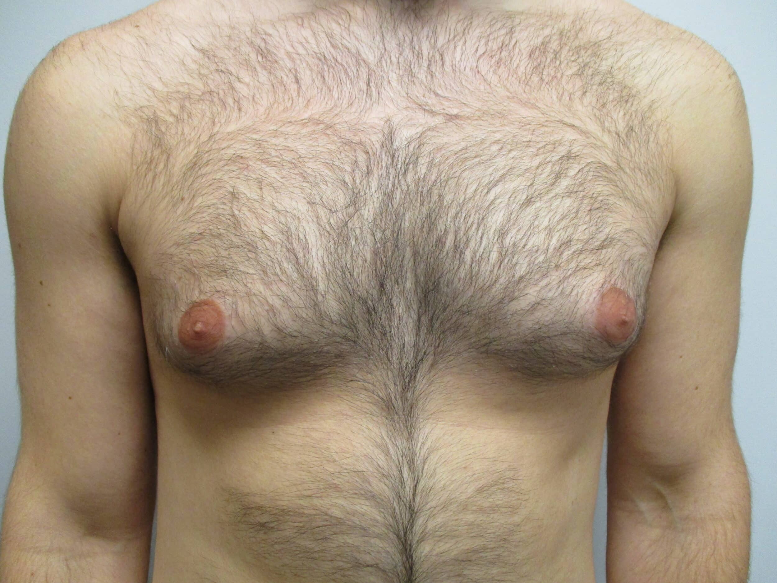 Before Image: Patient 22908 - front