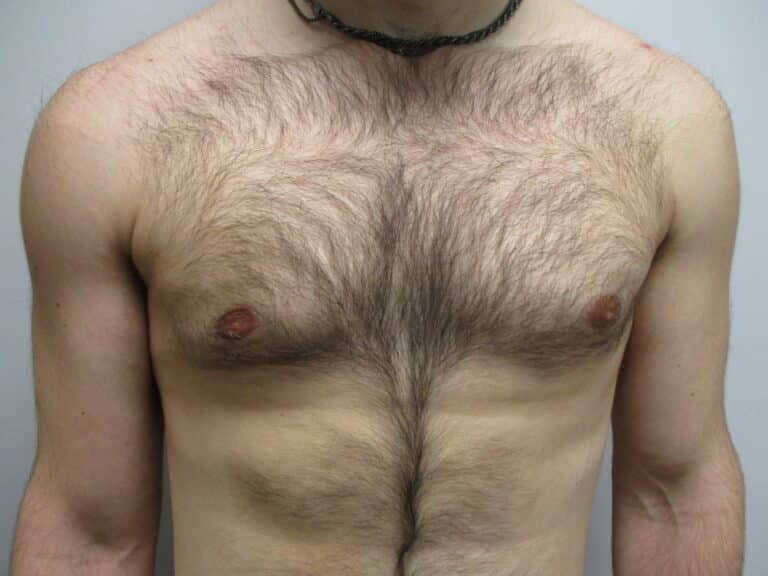 After Image: Patient 22908 - front