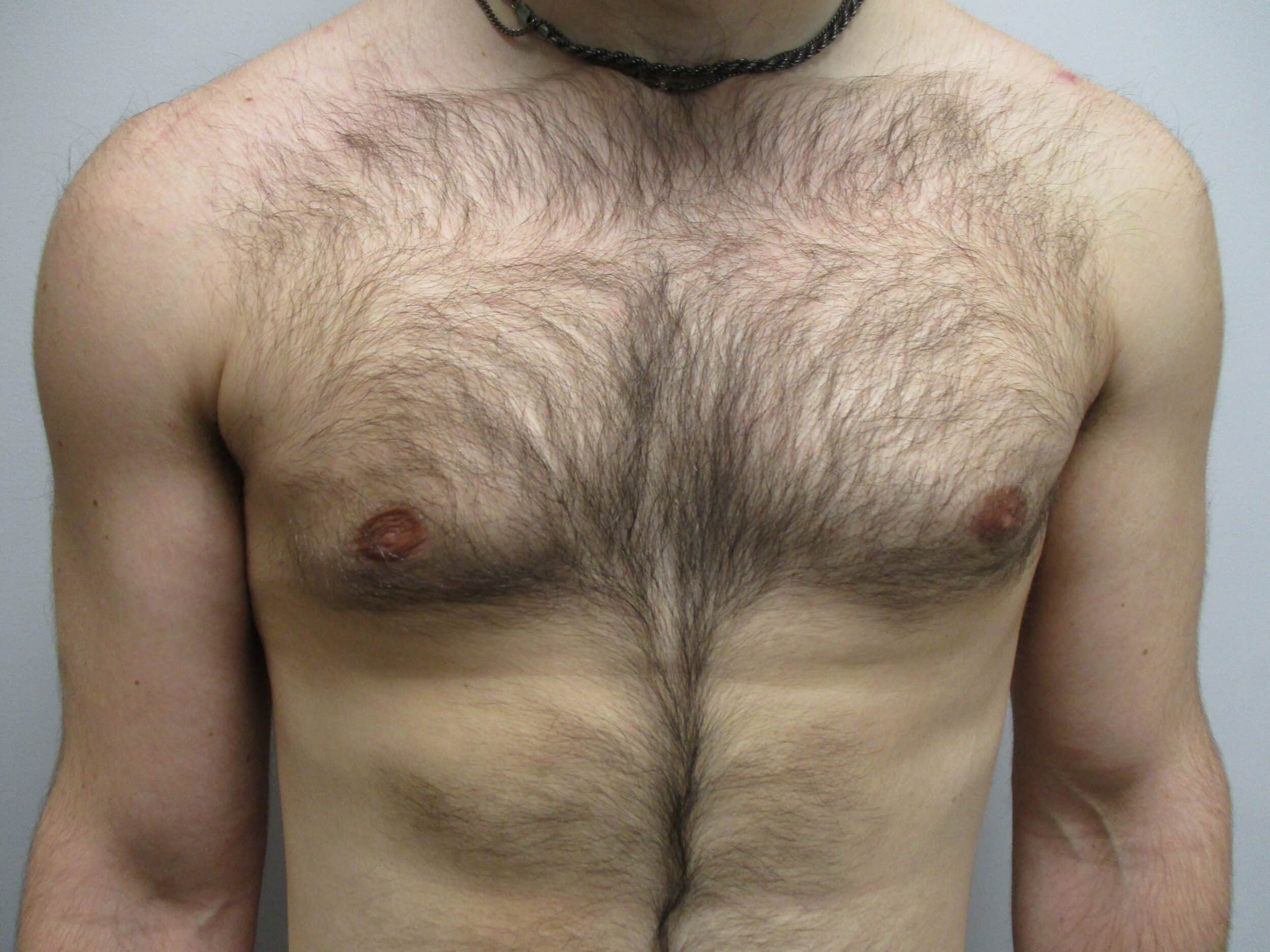 After Image: Patient 22908 - front