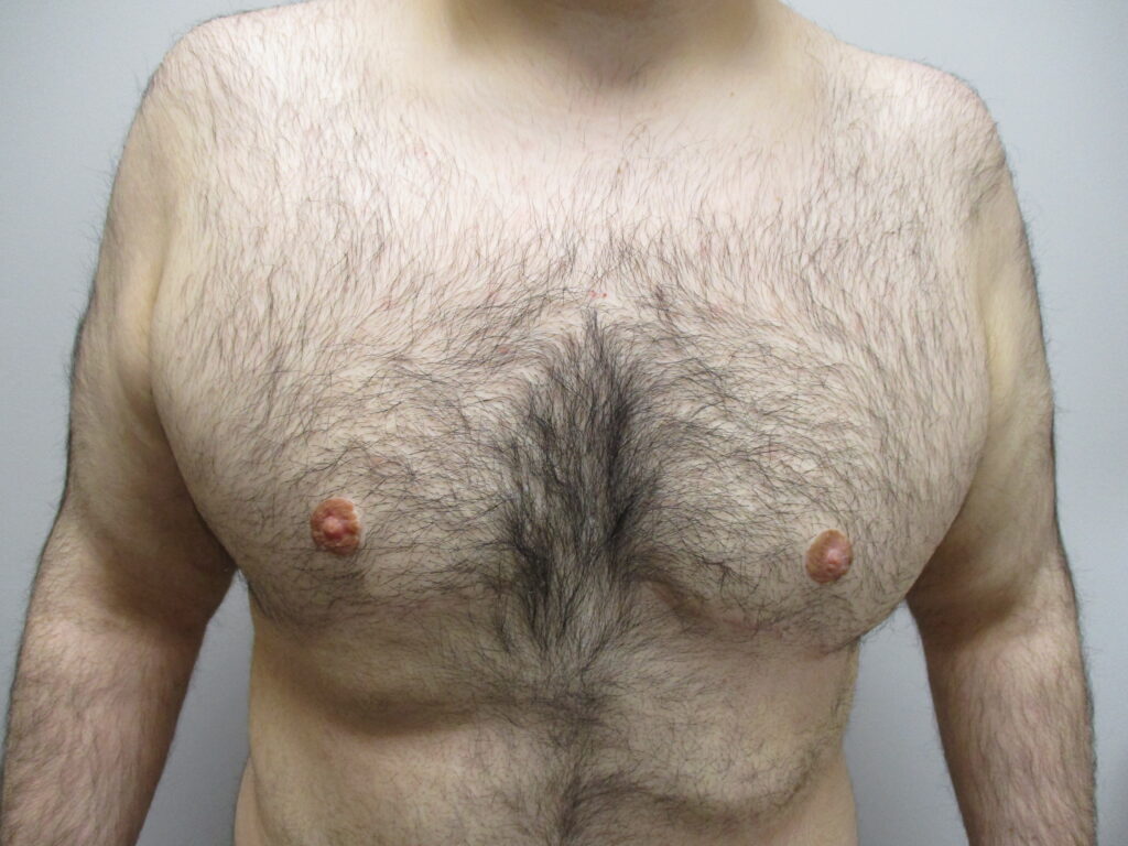 After Image: Patient 21225 - front