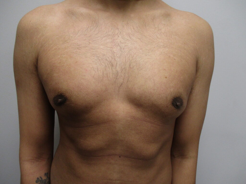 After Image: Patient 22904 - front